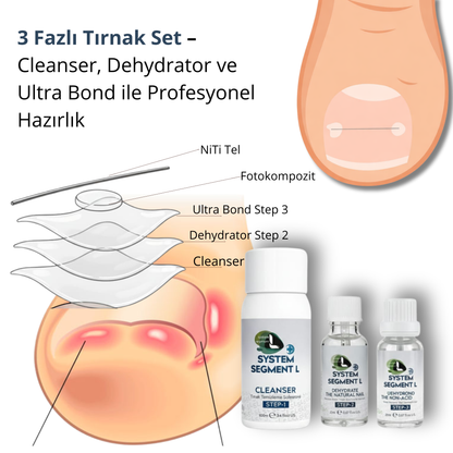 Tırnak hazırlık seti – titanyum tel ve medikal protez öncesi
Cleanser + Dehydrator + Ultra Bond – maksimum tutuculuk için 3 faz