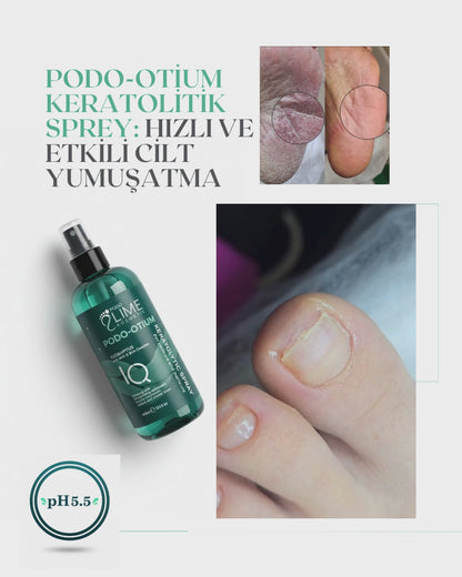 Podo-Otium Keratolytic Spray 400 ml – Nasır ve Sertleşmiş Deri İçin Hızlı Yumuşatma Spreyi
